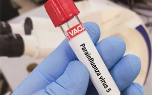 副流感病毒（HPIV1、2、3型）抗原檢測-免疫層析 （膠體金、彩色乳膠及熒光免疫層析）解決方案