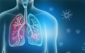 呼吸道感染病原體檢測(cè)高品質(zhì)原料推薦