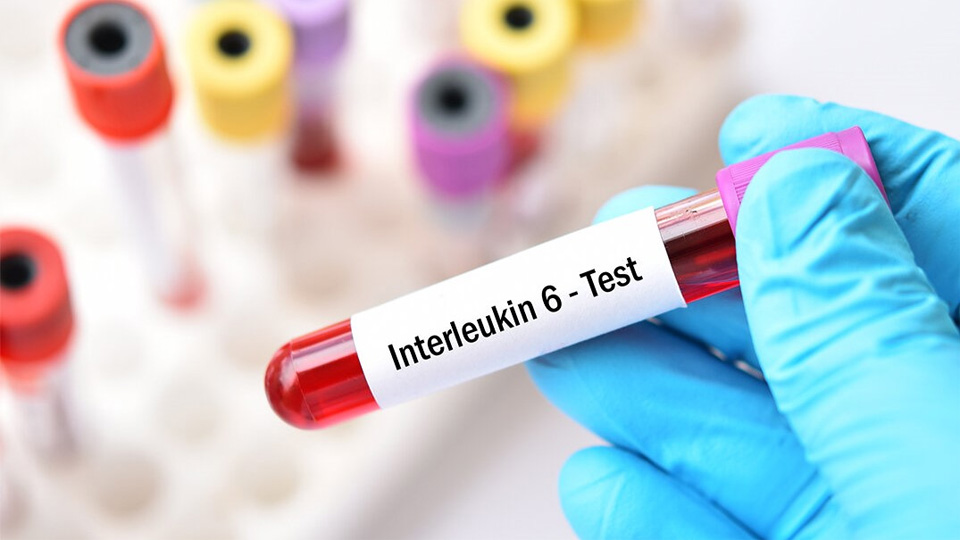 IL-6磁微粒化學(xué)發(fā)光熒光免疫層析