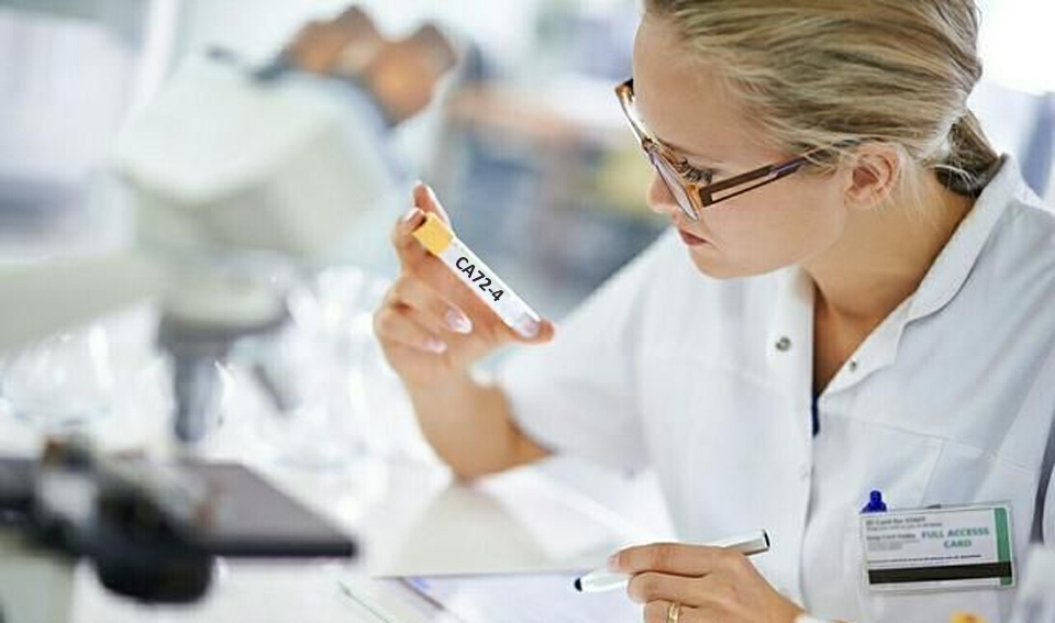 糖類抗原72-4（CA72-4）-磁微粒化學發(fā)光（吖啶酯）
解決方案